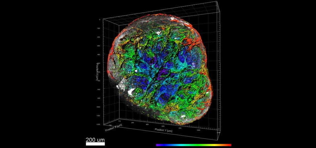 Human Vascular Organoids Reveal Clues for a Potential COVID Treatment