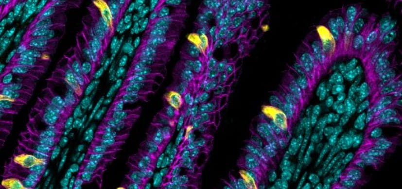 Alenghat-Tuft-cell-THUMB.jpg Can the Bugs in Our Guts Help Manage Inflammation?