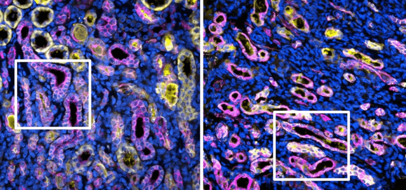 Location, Location, Location: A New Paradigm for Kidney Fibrosis