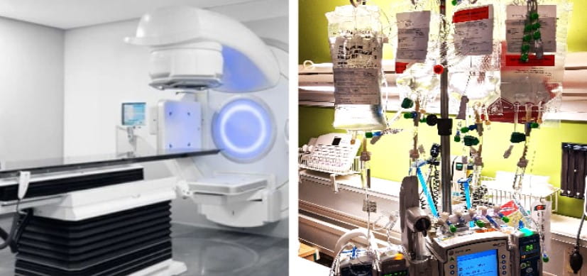 Study: Improved Chemotherapy and Surgery Eliminating Need for Radiation for Low-Grade Gliomas