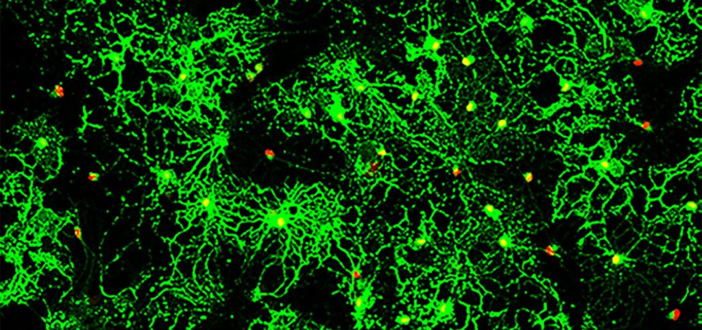 Small Molecule Shows Early-Stage Promise for Repairing Myelin Sheath Damage