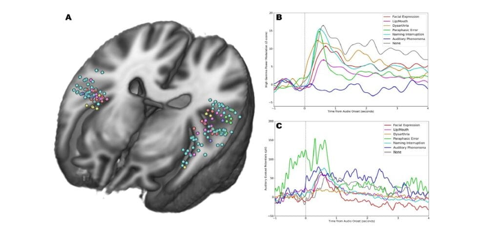 Brain Research Finds Unexpected Link Between Sound and Facial Expression