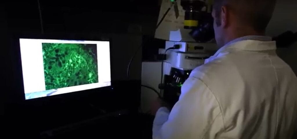 Tale of Two Studies Shows Mixed Progress Against EoE