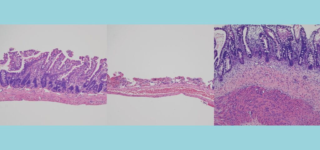 Organoid Medicine Milestone Reported in Cell Stem Cell