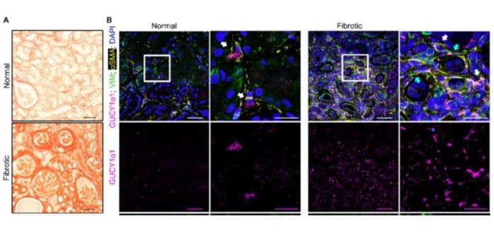 Gucy1α1 Acts as Fibrosis Biomarker in Multiple Organs
