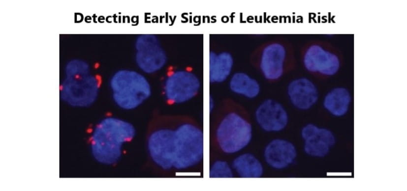How Bacteria in Our Aging Guts Can Elevate Risk of Leukemia and Perhaps More