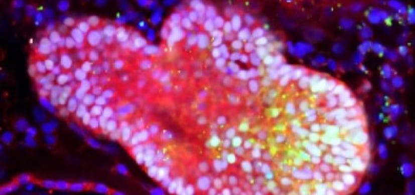 In Rodents, New Human “Multi-Zonal” Liver Organoids Improve Injury Survival