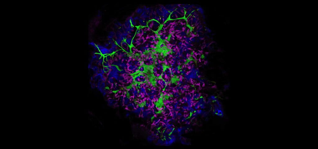 Advanced Kidney Organoids Produce Early-Stage Plumbing Needed for Removing Waste