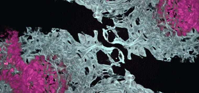 First Lung Organoid with Organ-Specific Blood Vessels