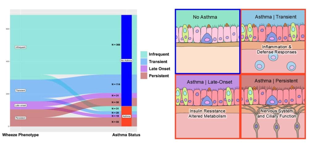 Childhood Wheeze Patterns Linked to Distinct Asthma Subtypes Later in Life