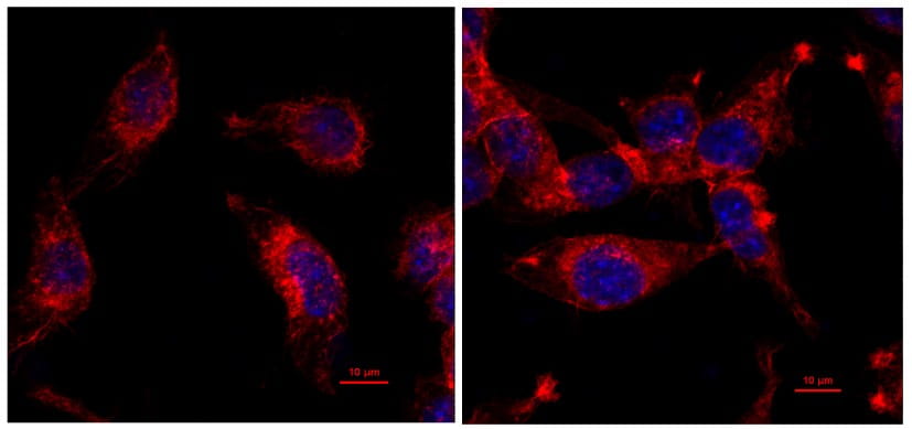 Hot New Clues for Treating Immune ‘Cold’ Tumors
