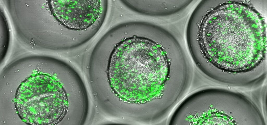 New Human Liver Organoid Platform Predicts Immune-Mediated Drug Toxicity