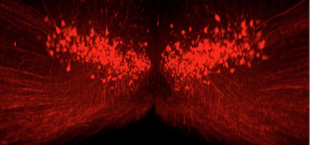 Spinal Cord Injury Alters Neuron Gene Expression