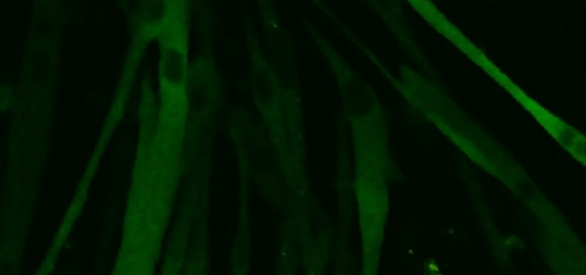 Surprising Insight May Put a Charge into Faster Muscle Injury Repair