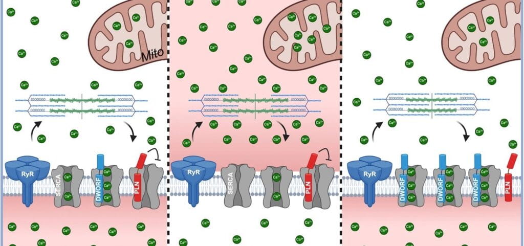 DWORF Gene Therapy Shows Early Promise for Treating Heart Failure