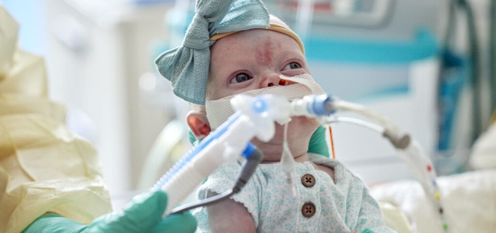 Study Reveals Novel Method to Spur Lung Blood Vessel Growth to Treat BPD