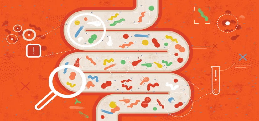Replacing Microbiota Makes Aging Intestines Young Again