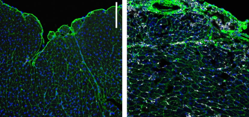 Discovery Could Make Immune Checkpoint Inhibitors Safer