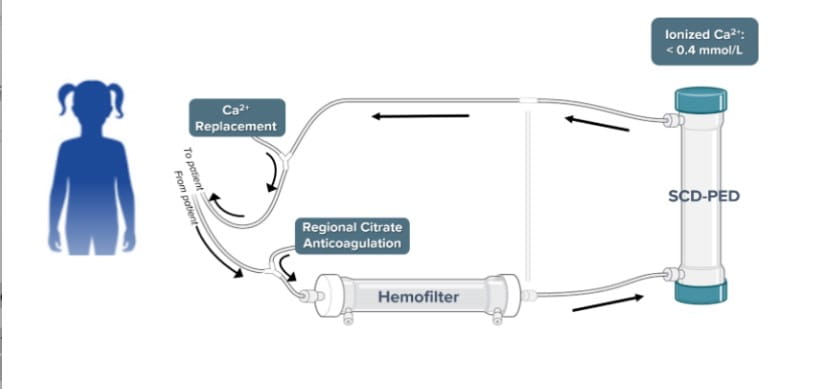 Kidney Injury Device Fares Well in Post-Approval Tracking Study