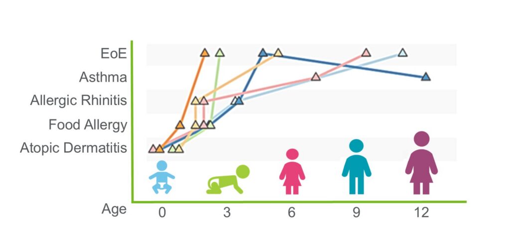 EoE-in-MPAACH-graphic_v2-1024x482.jpg EoE: The Fifth Member of the Atopic March