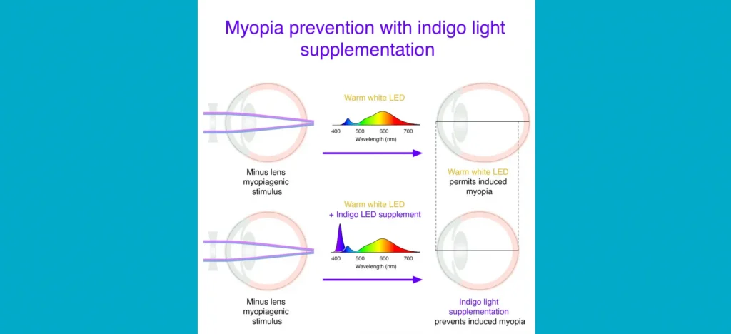 Restoring a Missing Slice of Sunshine to Indoor Light May Help Prevent Myopia