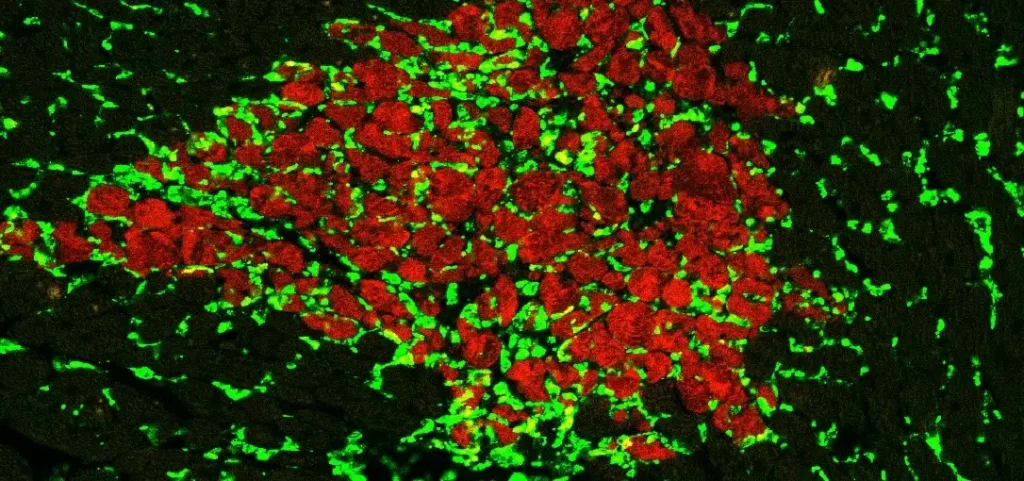 Study Challenges ‘Good Cop, Bad Cop’ View of Heart Immune Cell Roles