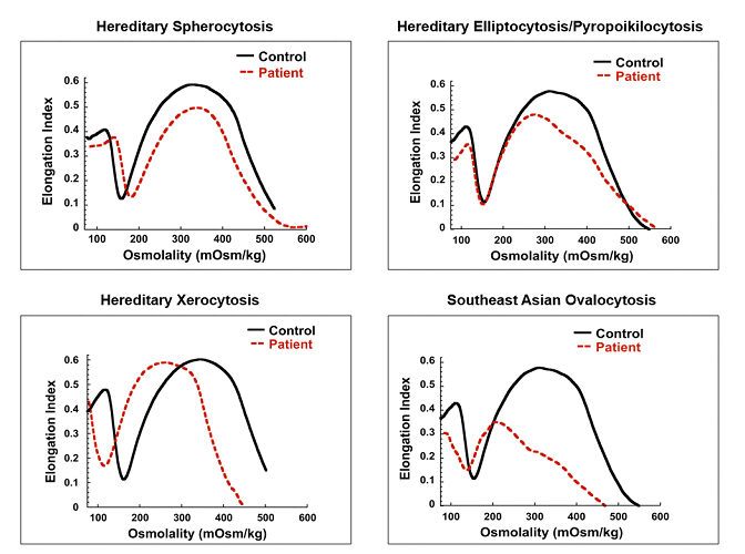 Examples of RBC membrane disorders detected by ektacytometry.