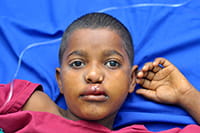 sudan-boy-after-200.jpg