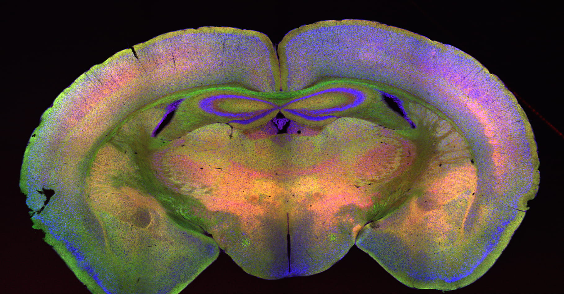 neuro
