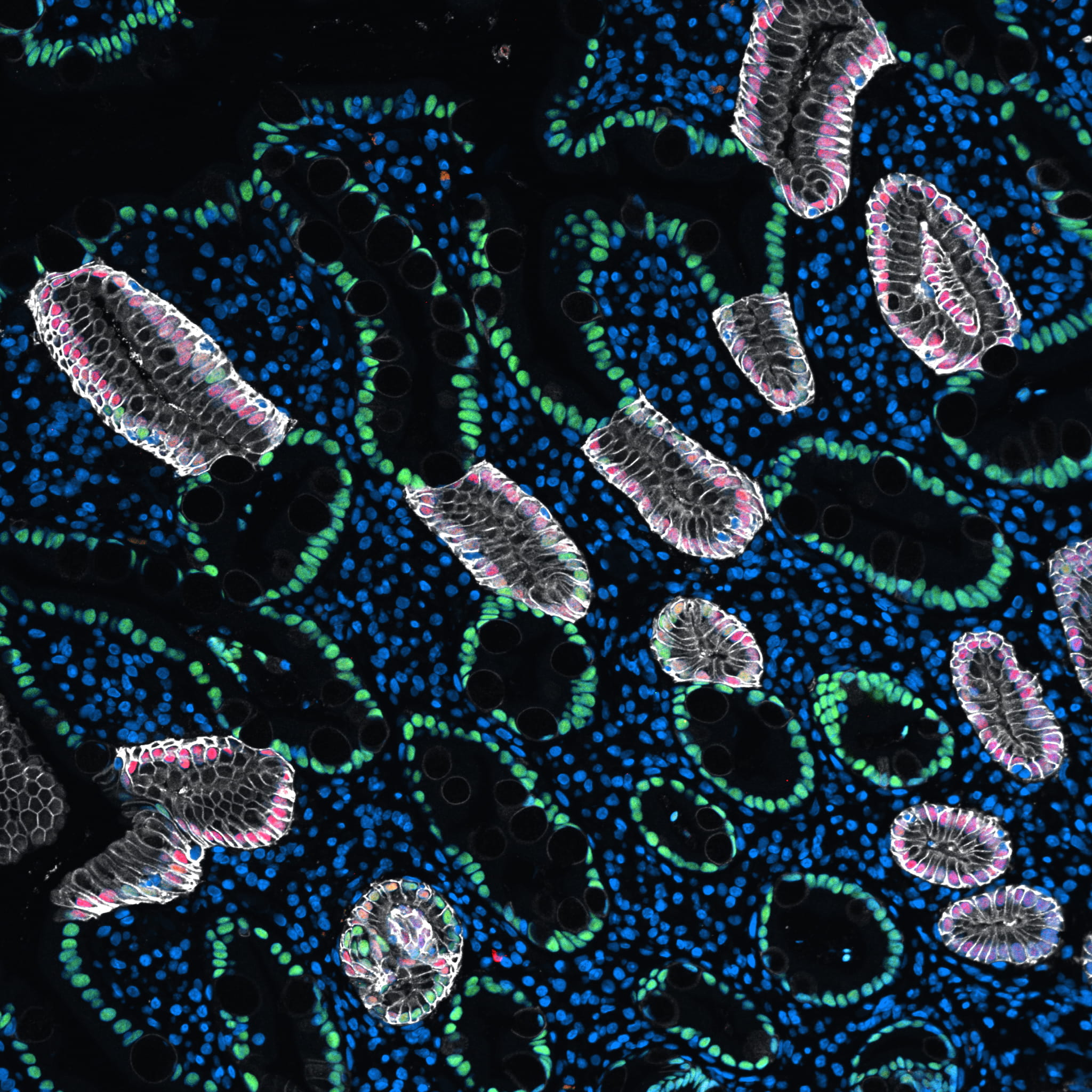stem cell
