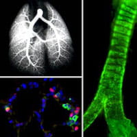 The research in this area focuses on normal perinatal pulmonary adaptation.