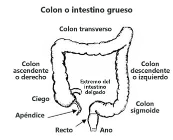 Hirschsprungs disease drawing.