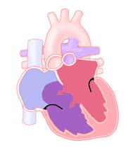 Atrioventricular septal defects.