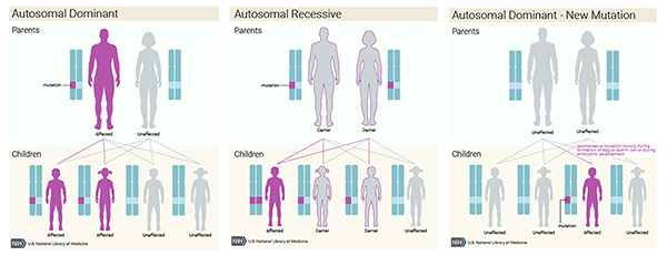 Stickler Charters Syndrome De Stickler Maladies – Syndrome De Stickler Causes Principales ...