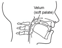 Figure 4.  Velopharyngeal insufficiency (the velum is too short for closure).