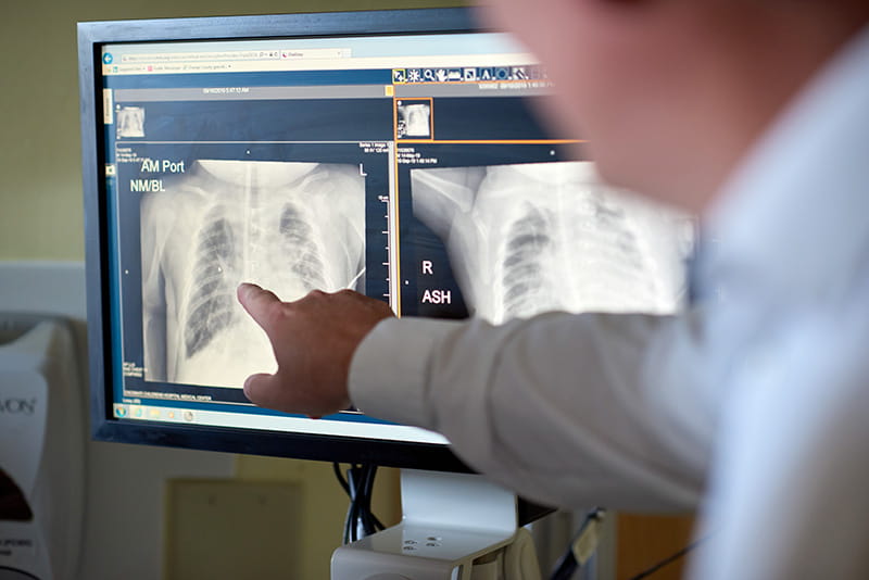 A photo of an x-ray.