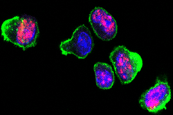 This image shows activated mouse T cells.