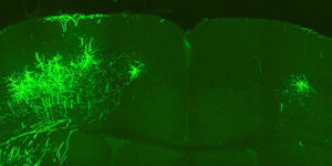 An image of the coronal brain region of a mouse.