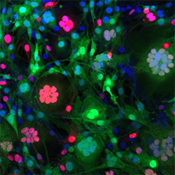 A microscopic image of fibroblast cells.