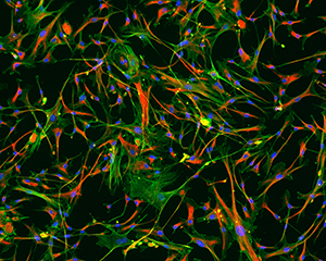 Donated heart cells from an adult heart failure patient.