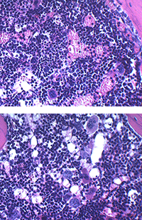 Bone marrow cellularity and composition.