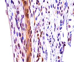 A section of obstructed extrahepatic bile duct in a neonatal mice. 