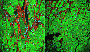 A microscopic image of two mouse hearts.