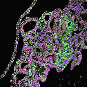 Confocal microscopic image shows tissue-engineered human stomach tissues.