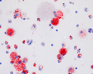 An image showing alveolar macrophages.