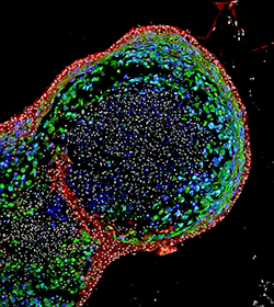 A microscopic image of a bioengineered human esophageal organoid.