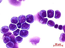 A microscopic image shows MLL-AF9 leukemia cells.