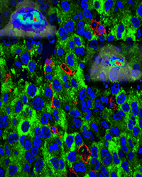 An image of molecularly stained brain cells.