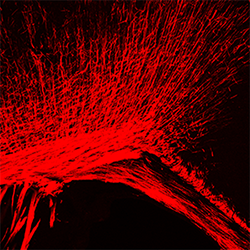 A microscopic image of a mouse brain.