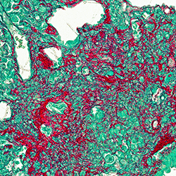 Tissue from a mouse lung with idiopathic pulmonary fibrosis.